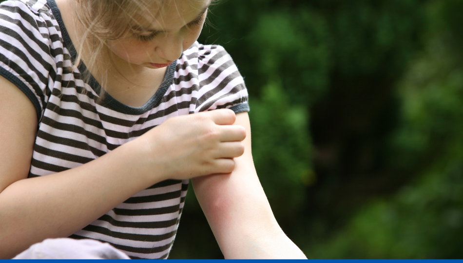 Comment se protéger des punaises de lit et de leurs piqûres ?